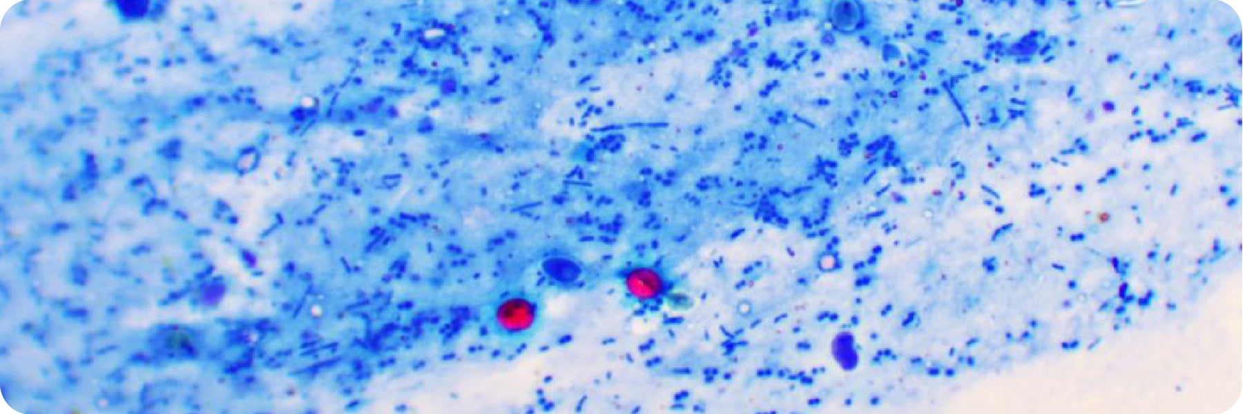 Combat cryptosporidium after the recent outbreak