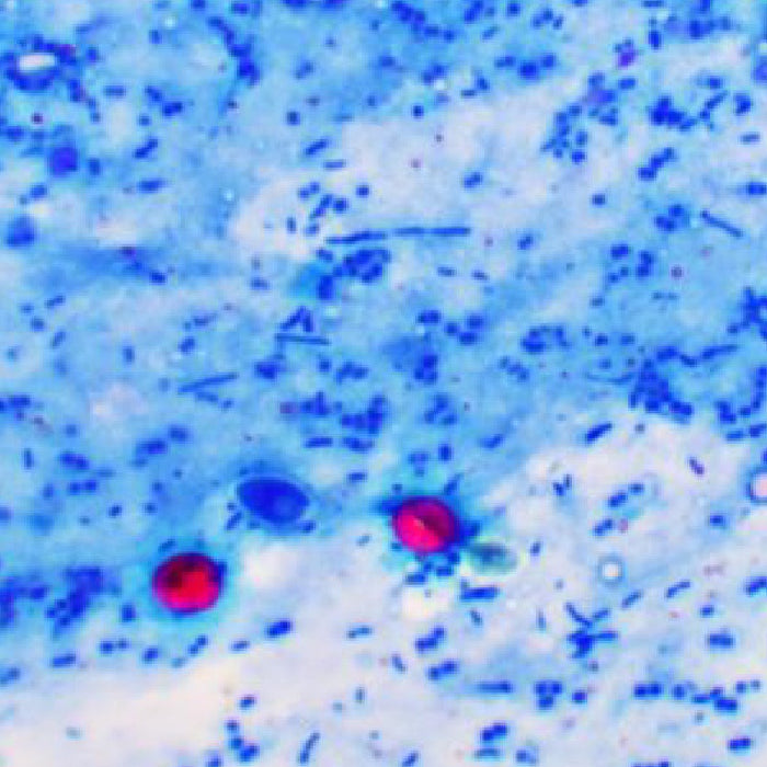 Combat cryptosporidium after the recent outbreak
